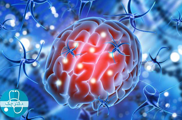 علت ها و عوامل بالا برنده احتمال ابتلا به سرطان مغز