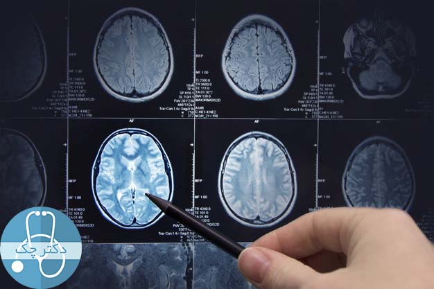 سرطان مغز از چه راه هایی تشخیص داده می شود؟