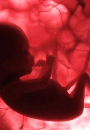 تاخیر در رشد جنین - چه عواملی باعث تاخیر در رشد جنین می شوند و چه راه های درمانی وجود دارد؟