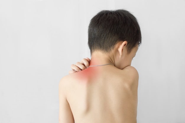 بیماری پوستی اگزما در کودکان