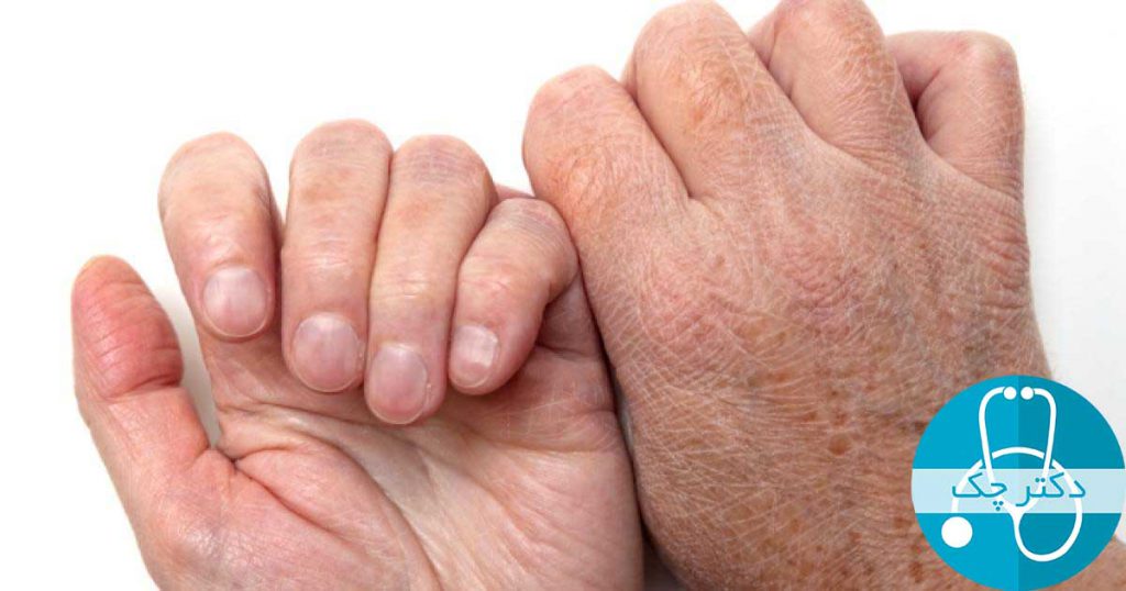 درمان های خانگی برای رفع ترک های پوستی دست، پا و لب