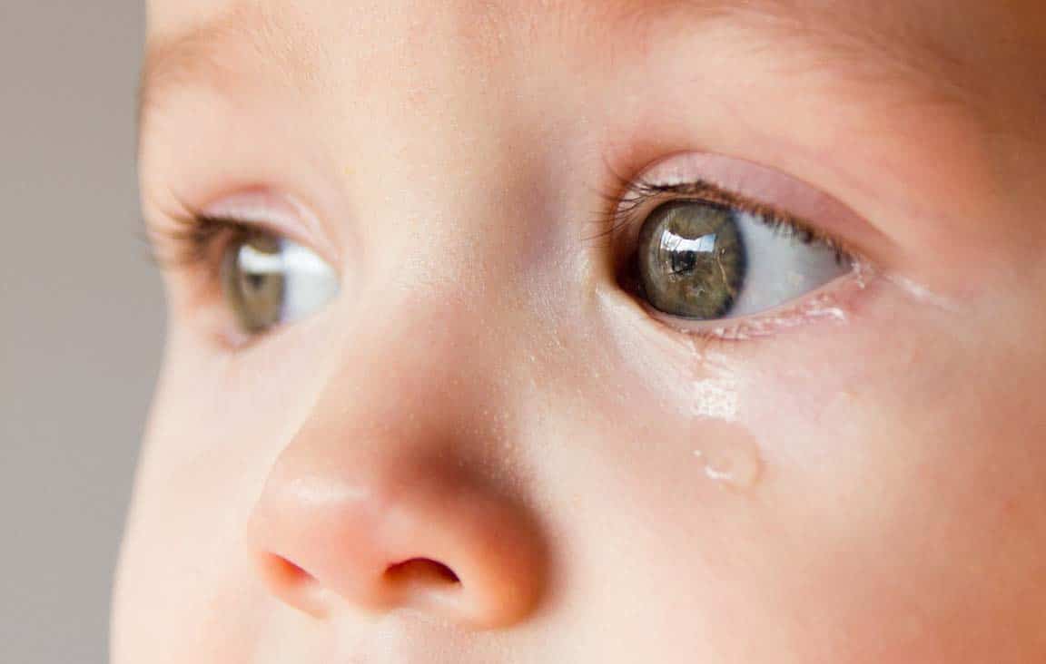 درمان آبریزش چشم کودکان