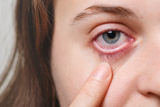 درمان عفونت چشم با عسل
