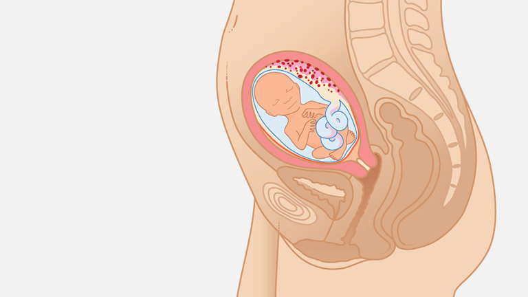 اندازه جنین در هفته هفدهم بارداری