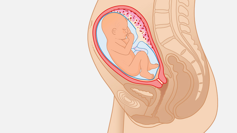 ظاهر جنین در رحم در هفته 28 بارداری