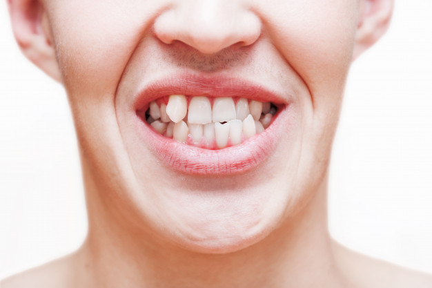 چه چیزی باعث خراب شدن دندان ها می شود