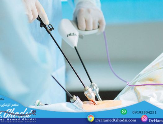 برای تو – هزینه عمل لاپاراسکوپی معده توسط دکتر قدسی چقدر است؟ (2021)