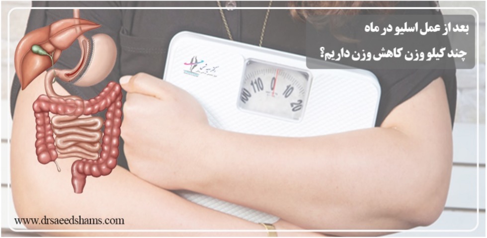بعد از عمل اسلیو در ماه چند کیلو وزن کم میشود؟