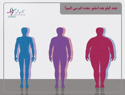 بعد از عمل اسلیو در ماه چند کیلو وزن کم می‌شود؟