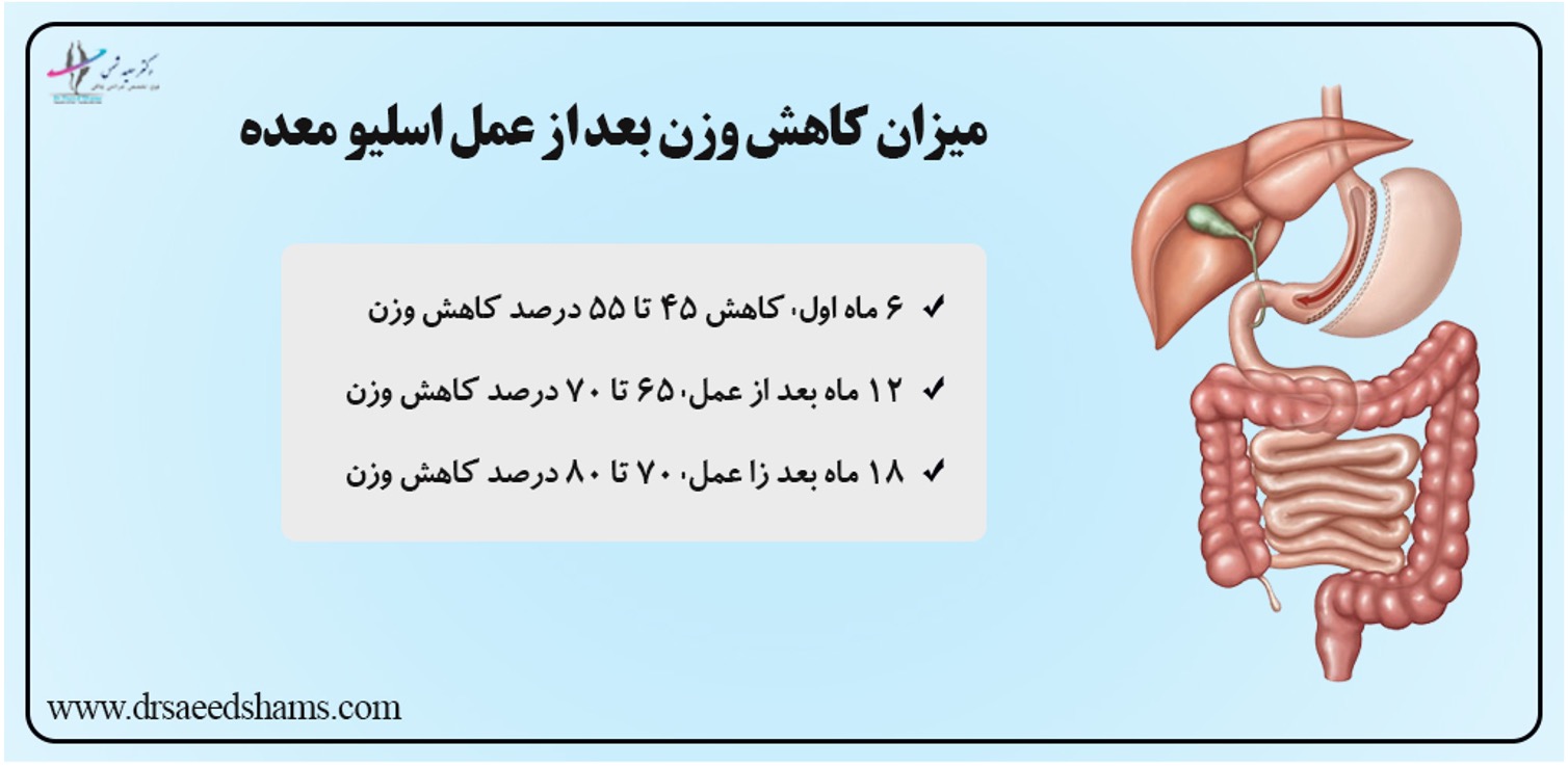 بعد از عمل اسلیو در ماه چند کیلو وزن کم میشود؟