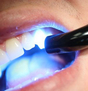 20درصد تخفیف همراه با پرداخت اقساطی در دندانپزشکی صادقیه