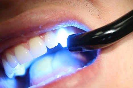 20درصد تخفیف همراه با پرداخت اقساطی در دندانپزشکی صادقیه