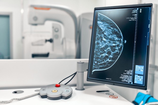ماموگرافی با هوش مصنوعی