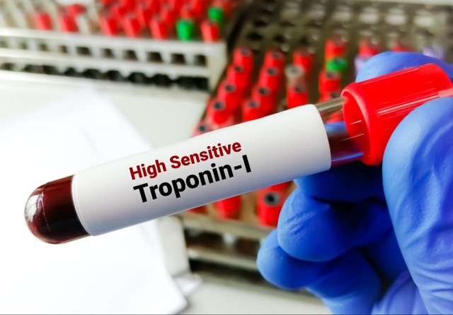 https://drchek.ir/wp-content/uploads/2023/08/High-troponin-levels-associated-with-increased-risk-of-death-from-any-cause3.jpeg