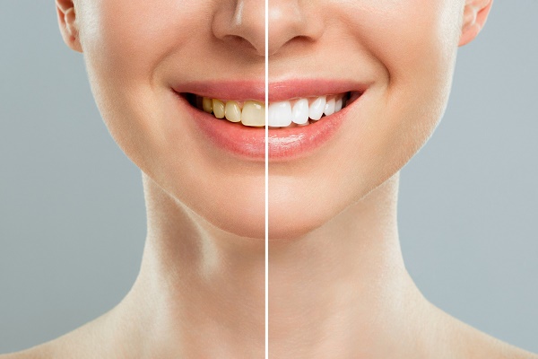 سلامت دهان با سرطان سر و گردن رابطه دارد