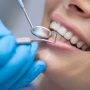 چه زمانی باید به دندانپزشک متخصص مراجعه کنیم؟