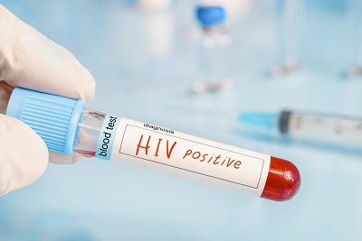 اختلال شناختی؛ با بعد دیگری از ویروس HIV آشنا شوید