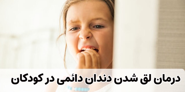 لق شدن دندان دائمی در کودکان