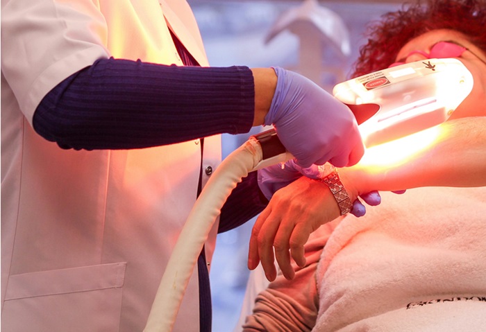 لیزر موهای زائد چند جلسه جواب میده