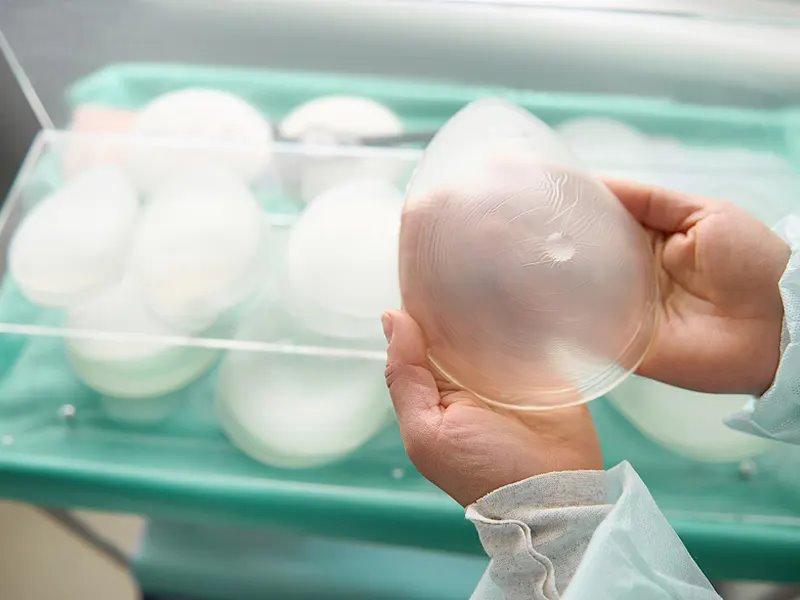 ماموپلاستی چیست و چه انواع دارد؟