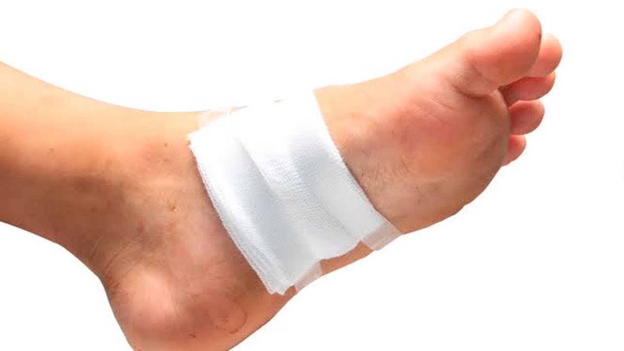 علائم اولیه زخم پای دیابتی