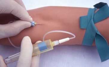 درمان پاره شدن رگ دست هنگام تزریق سرم