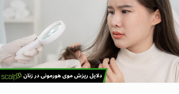 دلایل بروز ریزش موی هورمونی در زنان