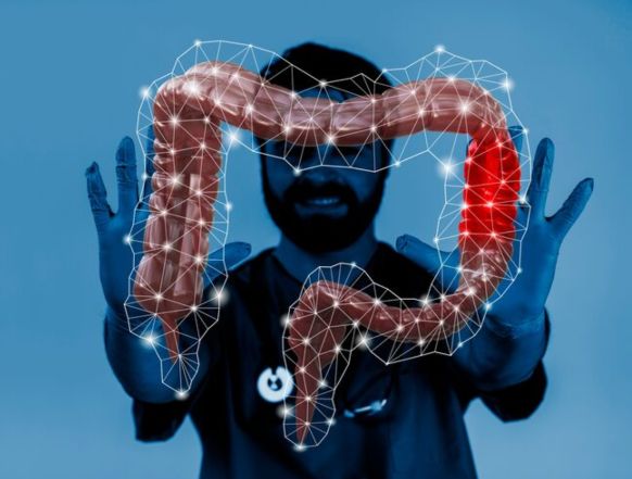 داروی ودولیزومب، راه بهبود سریع بیماری کرون